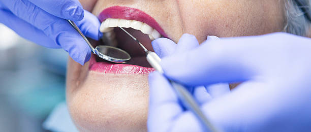 Best Emergency Denture Repair in Union Beach, NJ